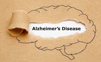 Alzheimer's Disease